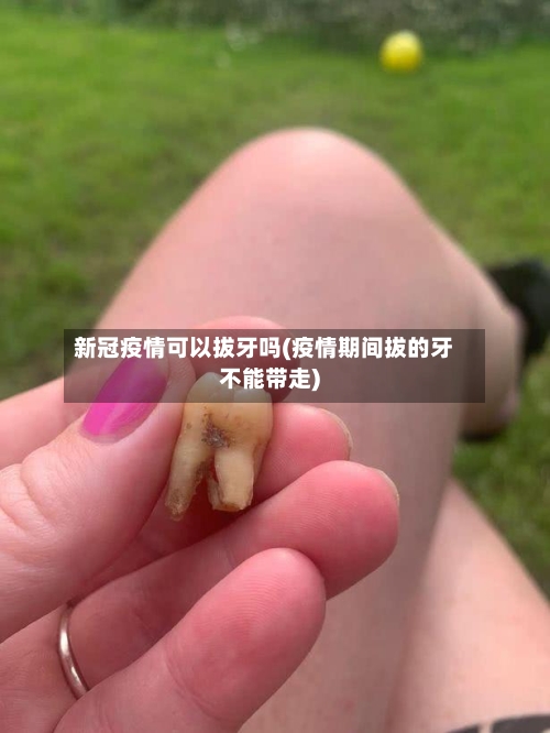 新冠疫情可以拔牙吗(疫情期间拔的牙不能带走)