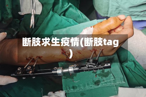 断肢求生疫情(断肢tag)-第2张图片