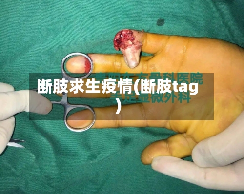 断肢求生疫情(断肢tag)