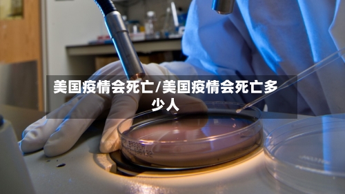 美国疫情会死亡/美国疫情会死亡多少人-第3张图片