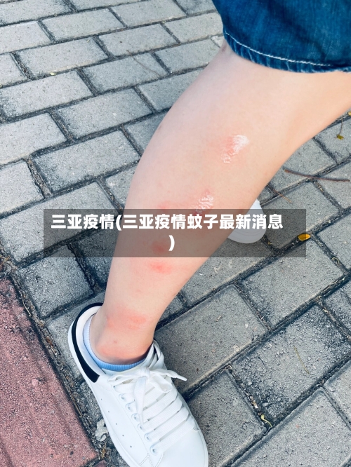 三亚疫情(三亚疫情蚊子最新消息)-第2张图片