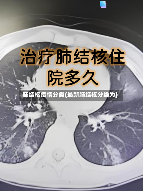 肺结核疫情分类(最新肺结核分类为)
